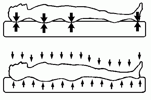 Grafik: Druckpunkte beim liegen auf dem Rücken